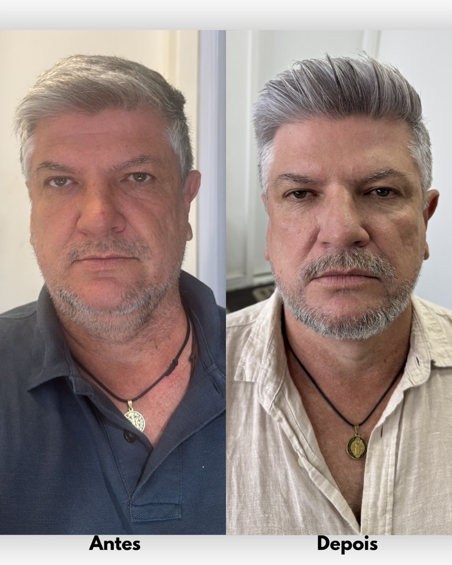 Antes e depois de cliente de visagismo masculino