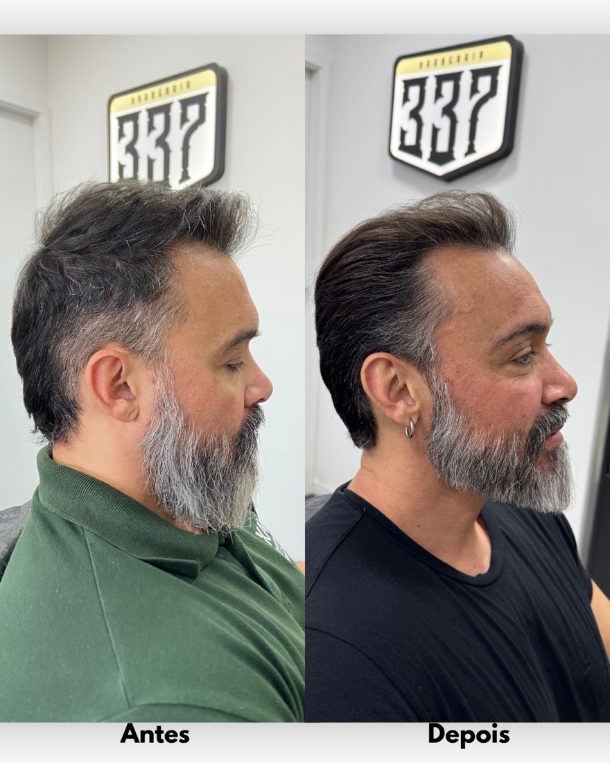 Antes e depois lateral de cabelo e barba masculina